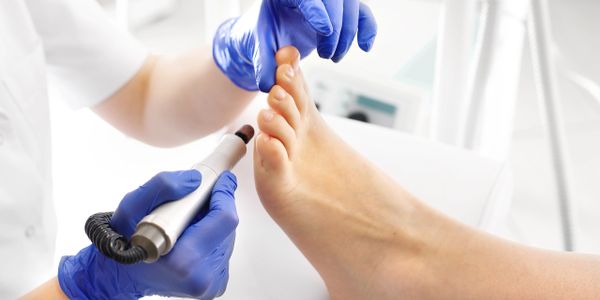 A podiatrist treating a patient's foot using a rotary tool.