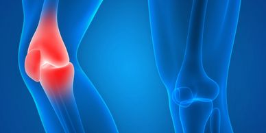 Digital illustration showing knee joint inflammation with red highlights.