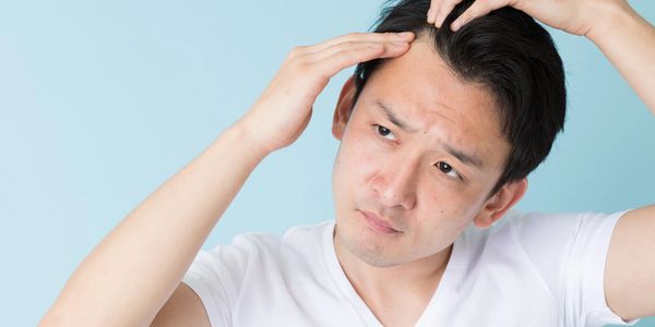Man examining his scalp with concern.