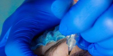 Close-up of a cosmetic procedure being performed on an eyebrow.
