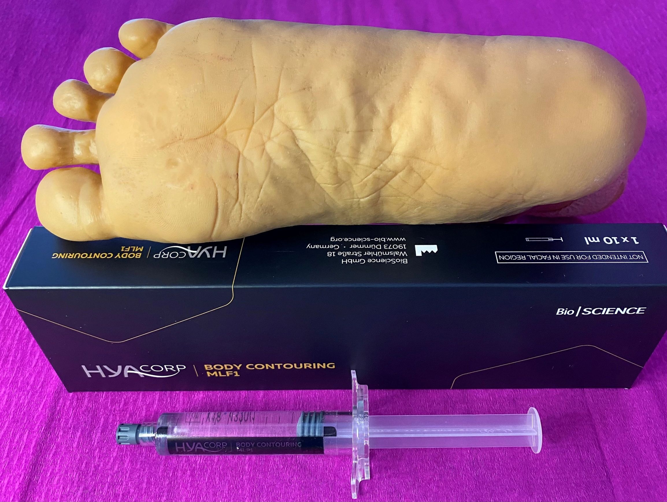 Foot cushioning filler injections with Hyacorp MLF1 hyaluronic acid gel. Replace fat pad loss.