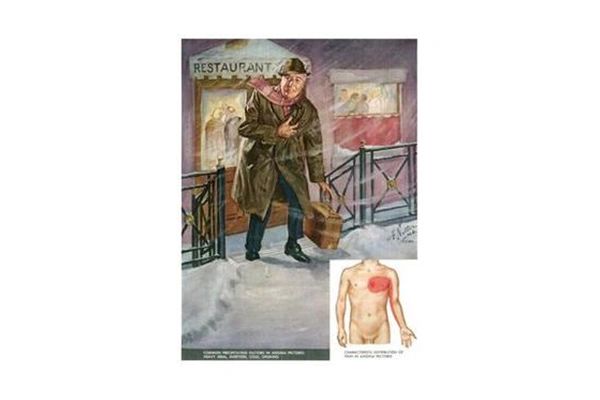 Low Levels of HDL Raise the Risk of Heart Attacks and Death