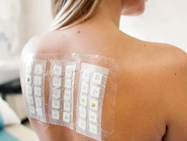 patch skin allergy test