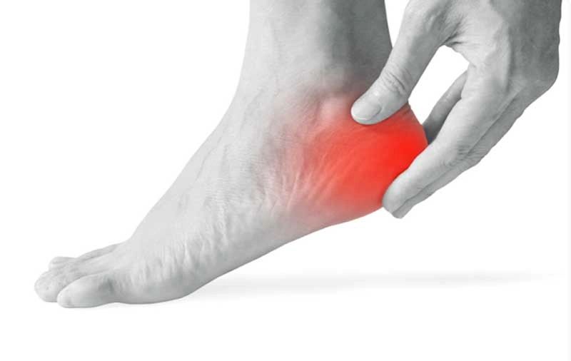 Navigating VA Disability Benefits for Plantar Fasciitis