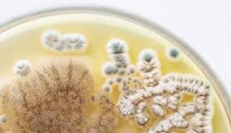 Microorganisms under a microscope