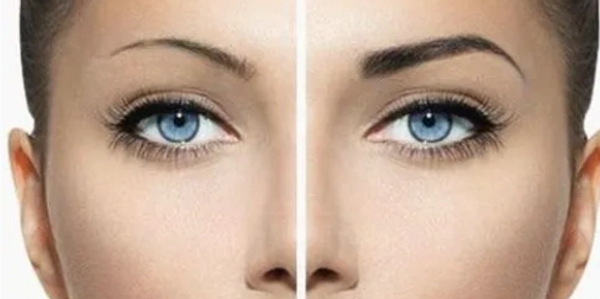 Before and after Microbladed Brows