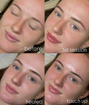 Before and after eyebrow treatment photos of a woman.