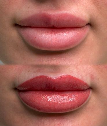 Comparison of natural lips and lips with red lipstick.