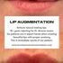 Lip Filler lip augmentation by Dr. Edward Alvarez Madison Avenue Face and Body NYC and Miami