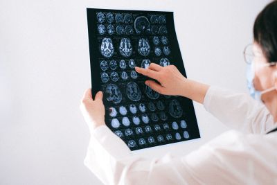 Doctor examining brain MRI scans.