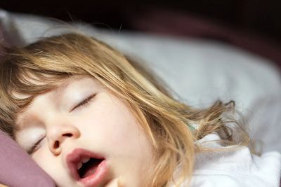 Mouth breathing in children