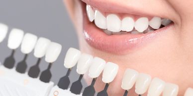 composite bonding, fillings, whitening at North Star Dentistry in Mississauga.