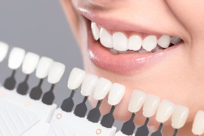 Fillings, dental bonding