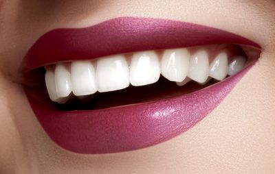 Dental Veneers - Porcelain, Zirconia and Resin Veneers
