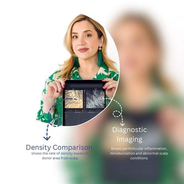 Woman presenting diagnostic scalp imaging and density comparison on a tablet.