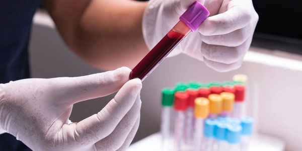 Gloved hands holding a blood sample tube with multiple colorful test tubes in the background.