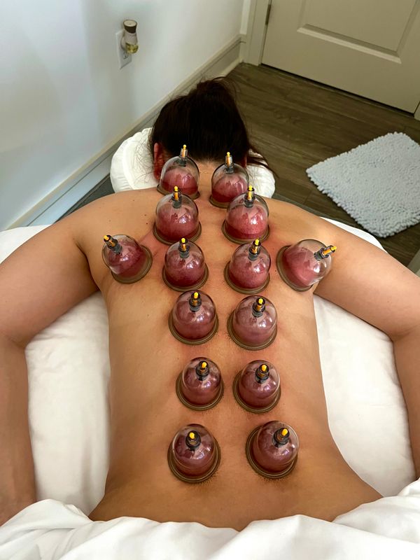 Full Body Cupping