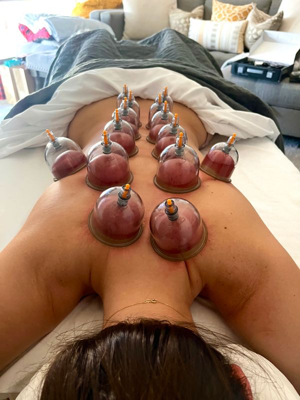 Cupping Massage