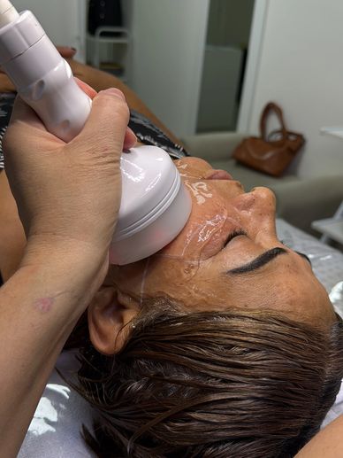 Sessão criofrequencia facial para  rejuvenescimento em clinica Modele Itaboraí rj