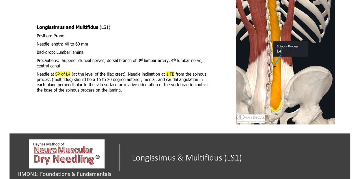 Longissimus and Multifidus muscle dry needling description with anatomical image.