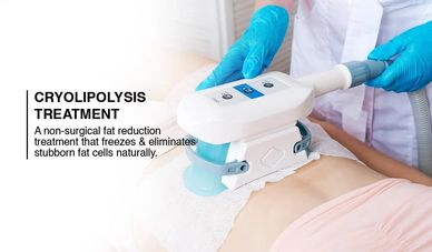 Cryolipolysis Treatment