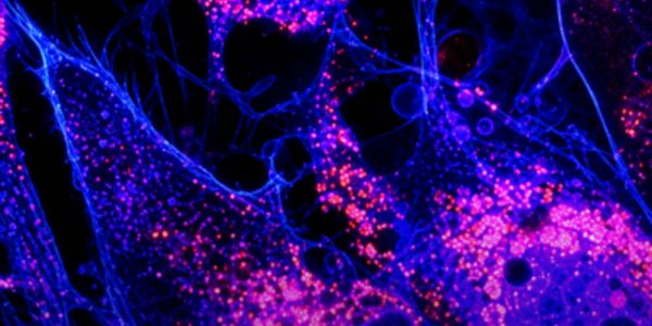 Microscopic view of cells stained in blue and pink.
