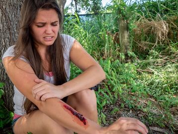 Woman with large, bleeding cut on her arm.