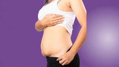 Tratamiento para la rehabilitación posparto en Cajicá