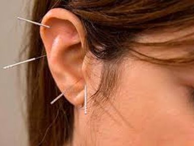 Auricular Acupuncture (also known as ear acupuncture) is a powerful yet gentle therapy based on the 