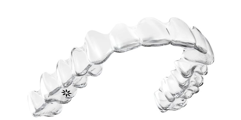 invisalign treatment with clear braces in waterloo 