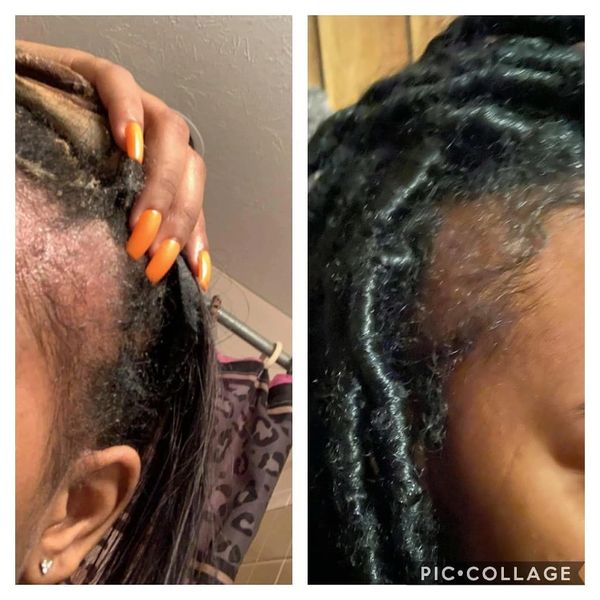 Consistent use of growth oil. 
1 month results!
