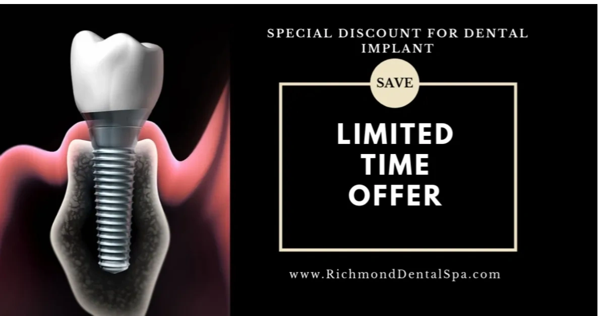 Richmond Dental Spa Limited offer dental implant