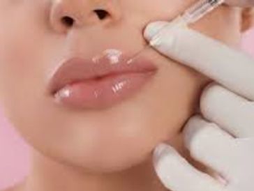 A person receiving a lip injection with a syringe.