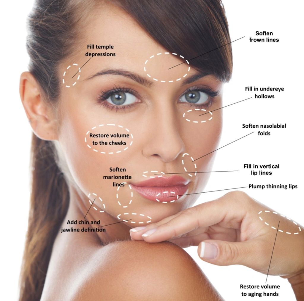 Dermal fillers near me in Gilbert.