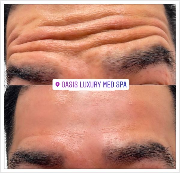 Advanced Aesthetics - Oasis Luxury Med Spa Advanced Aesthetics - Oasis Luxury Med Spa