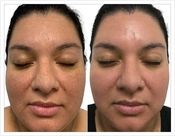 Advanced Aesthetics - Oasis Luxury Med Spa Advanced Aesthetics - Oasis Luxury Med Spa