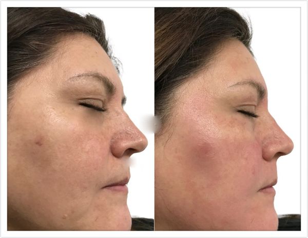 Advanced Aesthetics - Oasis Luxury Med Spa Advanced Aesthetics - Oasis Luxury Med Spa