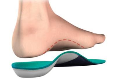 Plantar Fasciitis - ChiroKinetix Sports Medicine Clinic