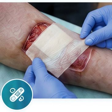 Clinician applying a wound dressing for advanced wound care and allograft treatment.