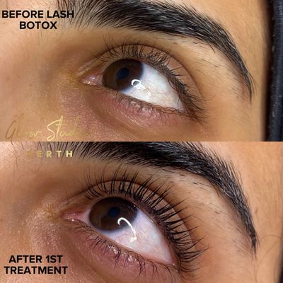 Does Lash Botox Treatment Work: Discover the Stunning Results