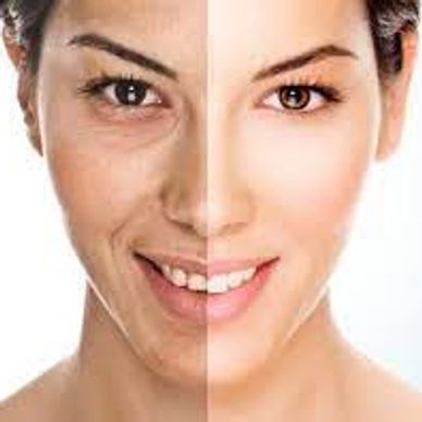 Tratamiento de BB Glow, Antes y Después