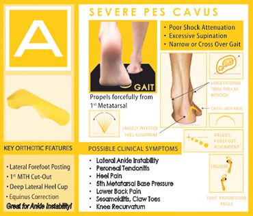 Quadra Step - A Type - Severe Pes Cavus