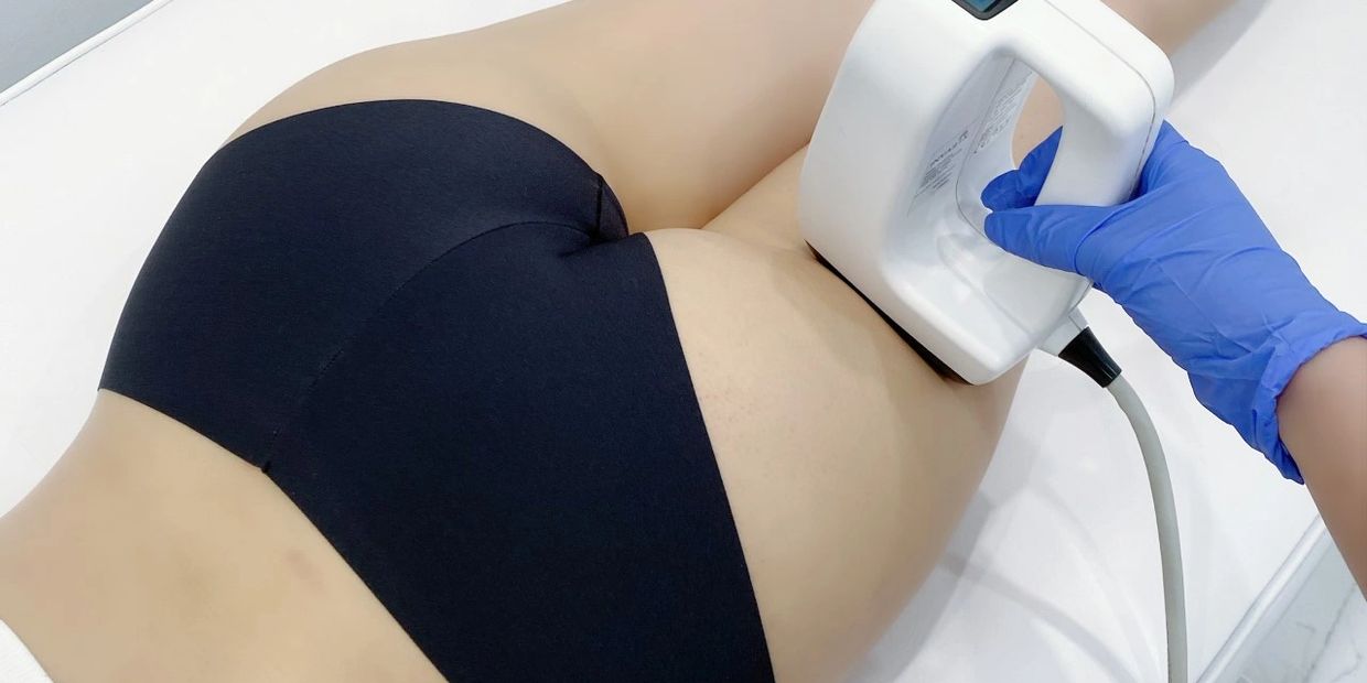 leg and thigh laser hair removal