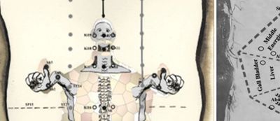 Avalon Acupuncture,Northern beaches, Northern Beaches Acupuncture,Acupuncture Northern Beaches