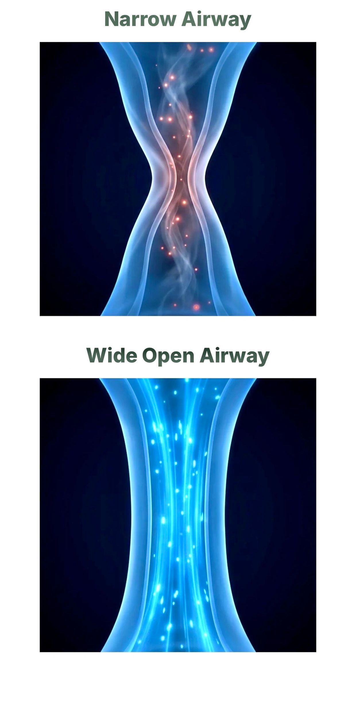 A narrow airway can be non-surgically corrected to improve your ability to breathe.  