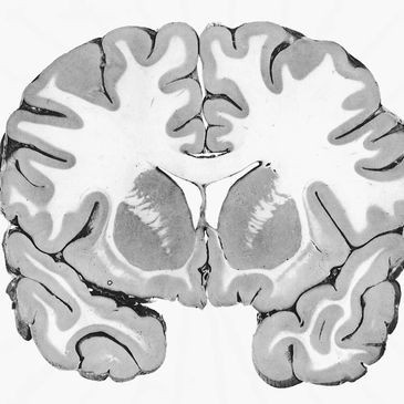 Grey and white matter