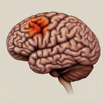 Image of a brain blockage stroke