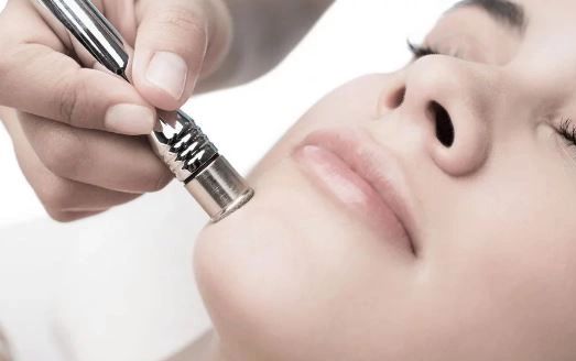 Microdermabrasion facial