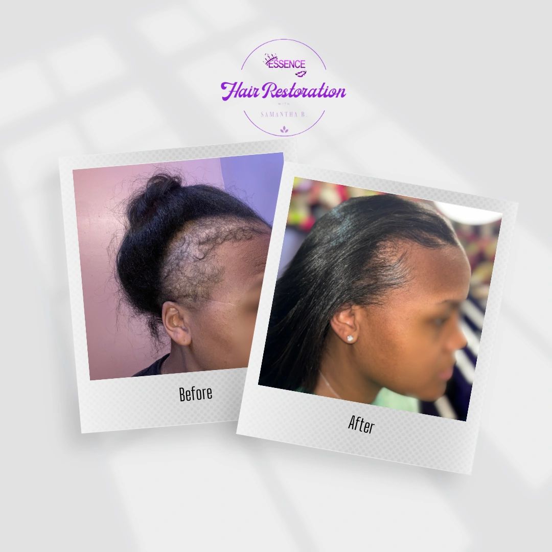 This specific client just gave birth and wa suffering from Postpartum TE (PPTE), which caused by unl