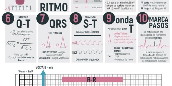 Electrocardiograma 